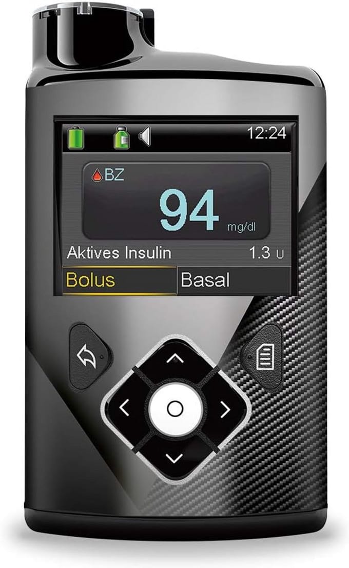 Decoratieve Sticker Carbon voor Insulinepomp Besturingsapparatuur - Perfecte Pasvorm