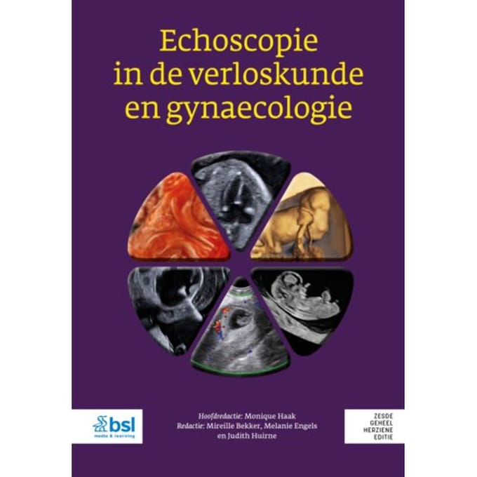 Echoscopie In De Verloskunde En Gynaecologie