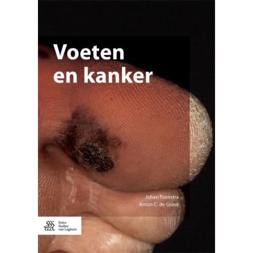 Voeten En Kanker - Johan Toonstra