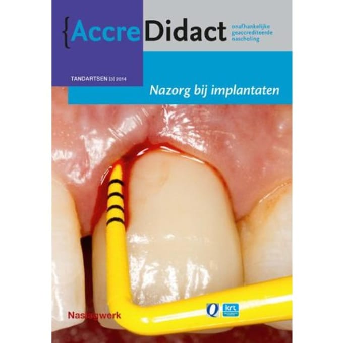 Nazorg Bij Implantaten - Accredidact - Gordon van der Avoort