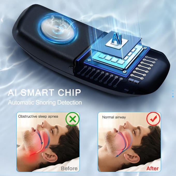 Slimme anti-snurk apparaat EMS Pulse Snoring Stop Effectieve oplossing Snurken Slaaphulp Draagbare geluidsreductie Spierstimulator XLARGE