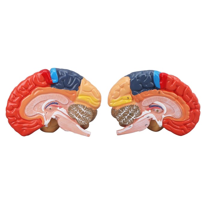 Anatomisch Menselijk Hersenenmodel Cerebrale Artery Kleur Gedeeld Links Rechts Hersenen Gemonteerd Model voor red