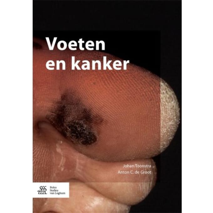 Voeten En Kanker - Johan Toonstra