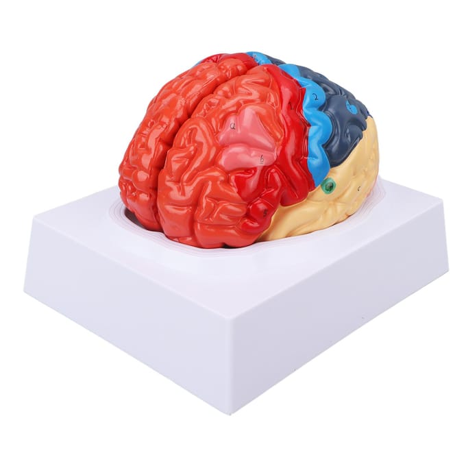 Anatomisch Menselijk Hersenenmodel Cerebrale Artery Kleur Gedeeld Links Rechts Hersenen Gemonteerd Model voor red