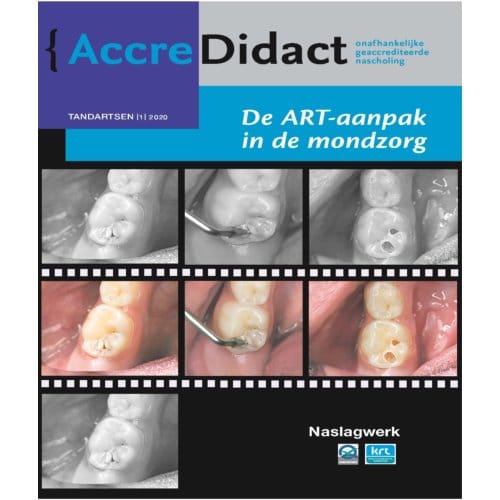De Art-Aanpak In De Mondzorg - Accredidact - Jo E. Frencken