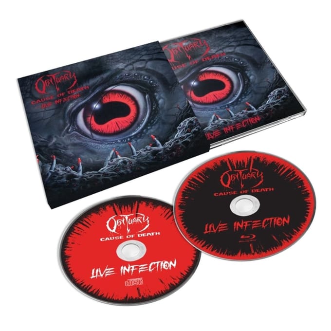 Cause Of Death: Live Infection - Obituary