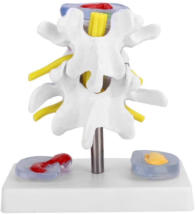 Allecto - Menselijk lumbale wervelmodel - Anatomisch skeletmodel