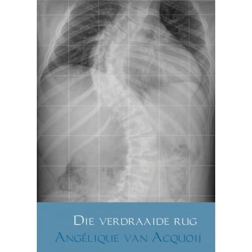 Die Verdraaide Rug - Angelique van Acquoij