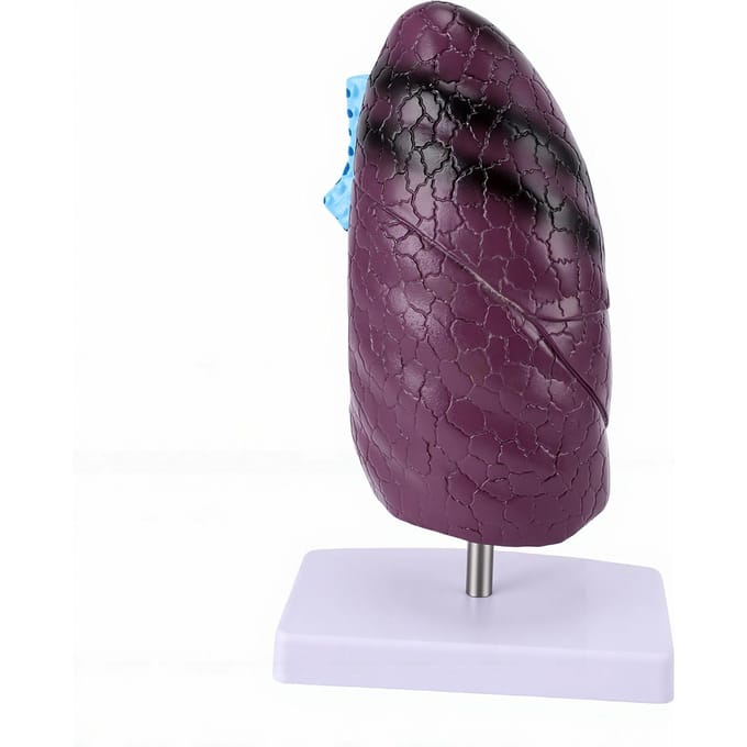 Long Anatomie Model Rokende Long Model Vergelijking Lesinstrument voor Anatomie Onderwijs gray