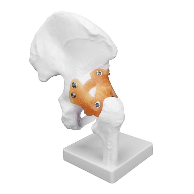 Professioneel Heupbot Model Realistisch Menselijk Heupgewricht Model Heupgewricht Onderwijs Skelet beige