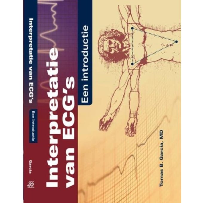 Interpretatie Van Ecg's - Tomas B. Garcia