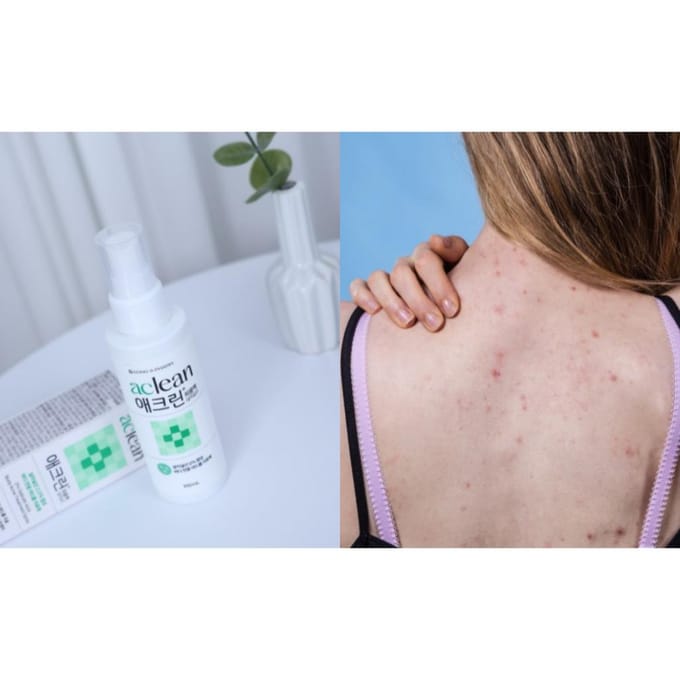 [Dong-A Pharm] Aclean Sol/Traitement de l'acné corporelle 100 ml white
