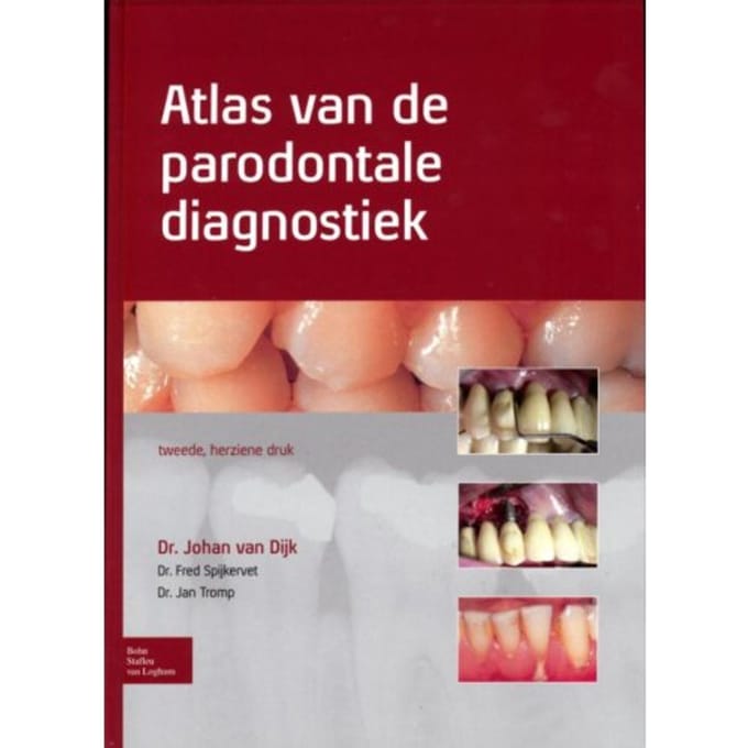Atlas Van De Parodontale Diagnostiek - Johan van Dijk