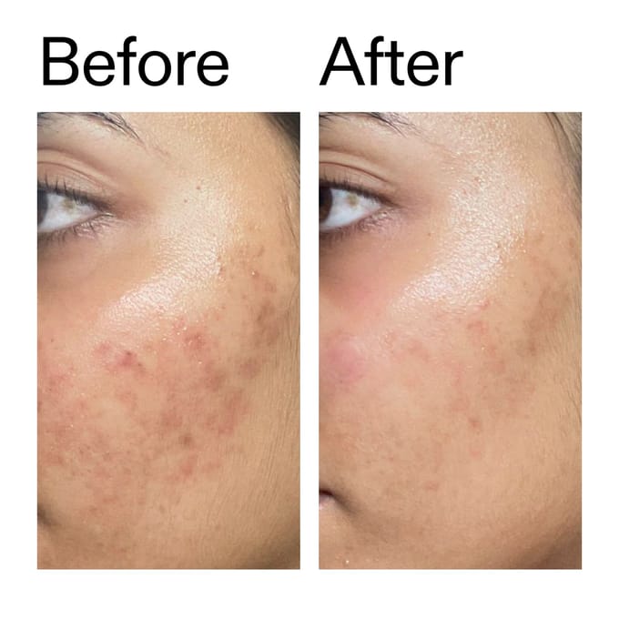 The INKEY List Ectoin Hydro-Barrier Serum