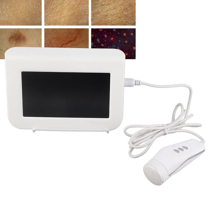 7 inch Oplaadbaar Type Hoofdhuid Haarzakje Huid Haar Detector Analyse Machine 100-240V EU Plug white