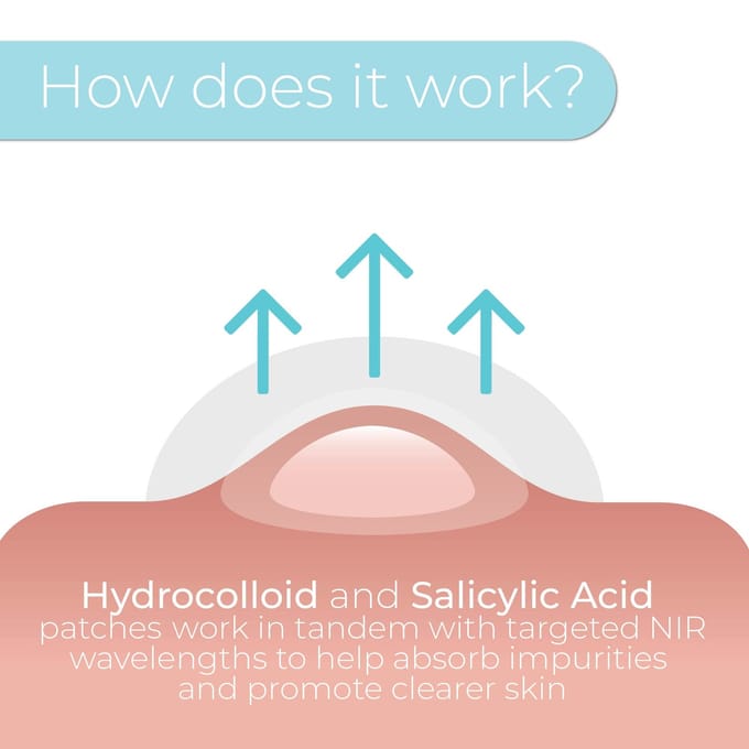 StylPro Hydrocolloid &amp; Salicylic Acid Replacement Patches 30 st