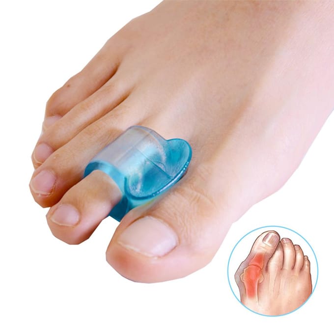 3 Paar Zachte Bunion Spreiders Silicone Gel Teenspreider Duim Corrector Voetverzorgingstool blauw