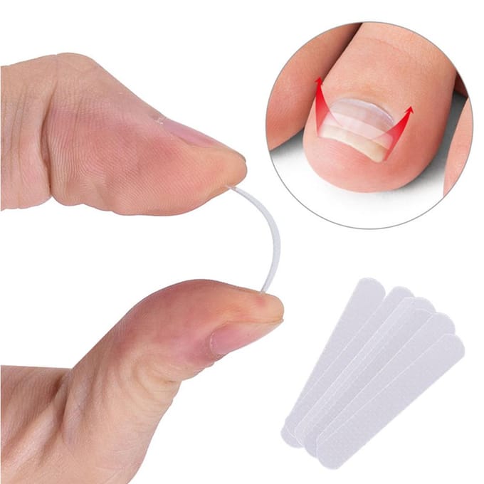 10 stuks ingegroeide teennagel rechttrekken clip ingegroeide teennagel correctie elastische patches paronychia 3.5mm white