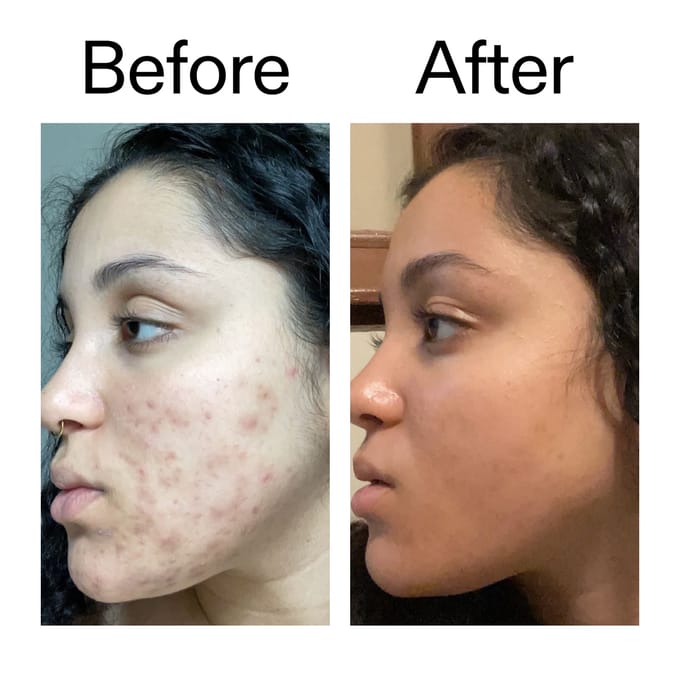 The INKEY List Tranexamic Acid Serum 30 ml