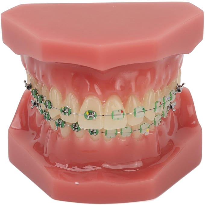 Modèle de démonstration orthodontique dentaire Modèle de dents avec fils métalliques et bracket pour l'enseignement brown