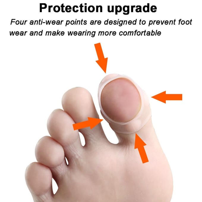 Outil de Correction d'Ongle Incarné Clip Élastique pour Redresser l'Ongle Correcteurs d'Ongles en Silicone beige
