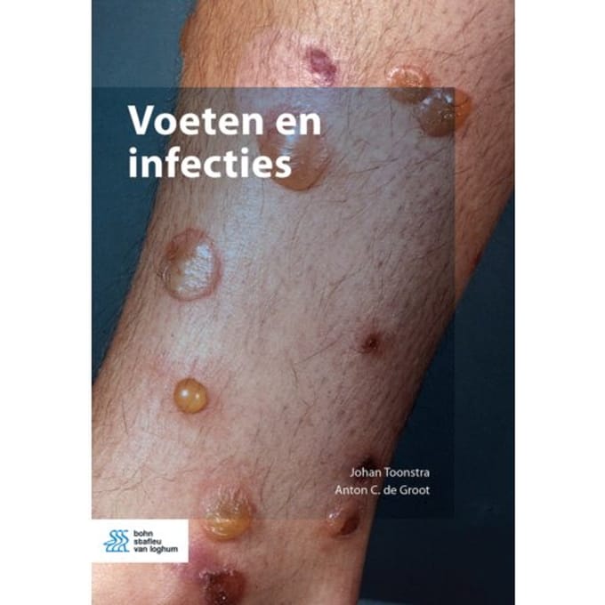 Voeten En Infecties - Johan Toonstra