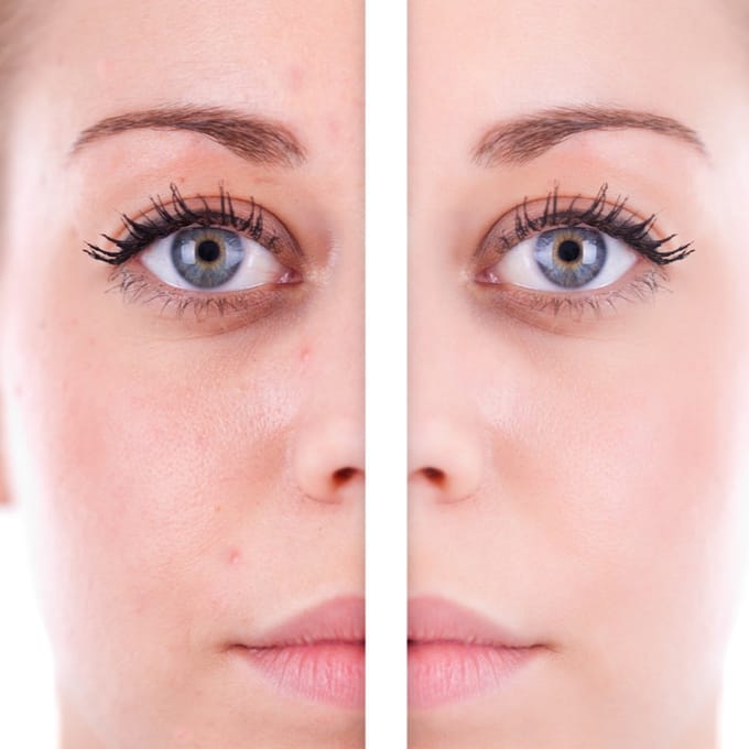 CORRECTOR MINT Kleur: Groen Doel: corrigeert roodheid, couperose, rode vlekjes en rosacea
