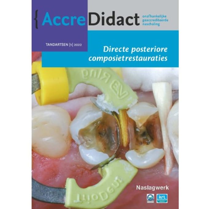 Directe Posteriore Composietrestauraties - Accredidact - Bas Loomans