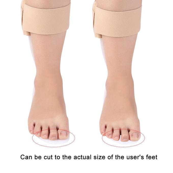 Verstelbare Voethefforthese Enkelcorrector Brace Ondersteuning Bescherming Spalk Linkervoet SM beige