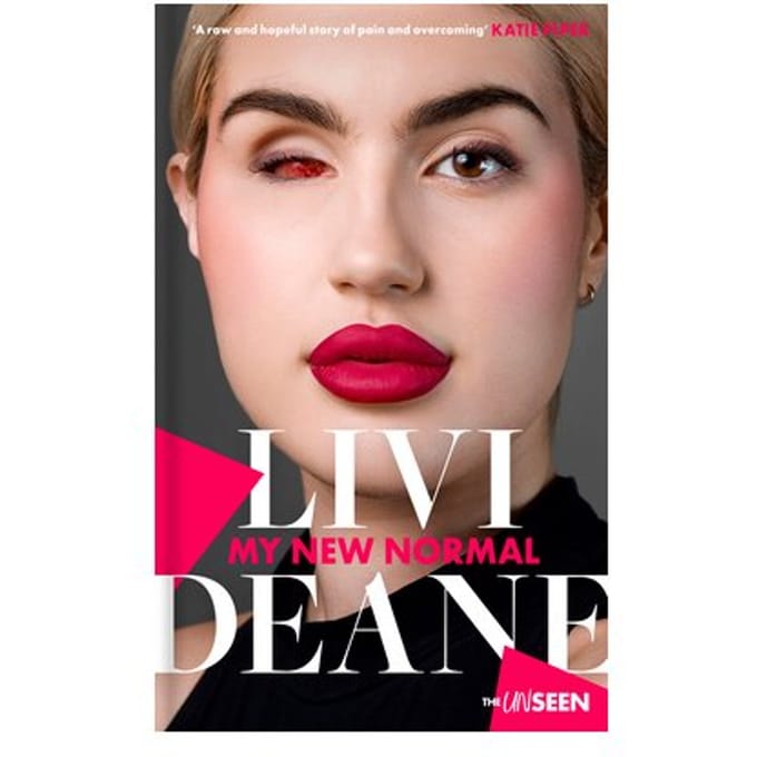My New Normal - Katie Piper's The Unseen - Livi Deane