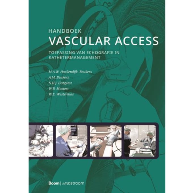 Handboek Vascular Access - M.A.W. Hoekendijk- Beukers