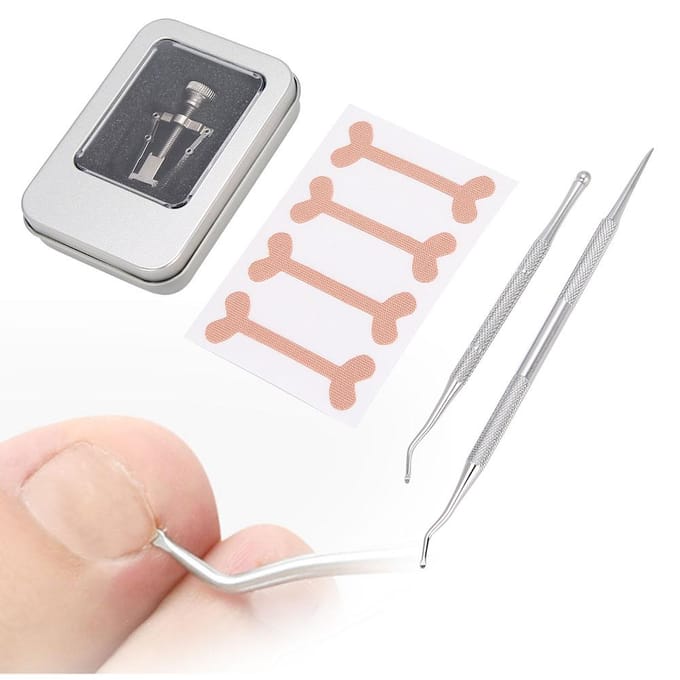 Ingegroeide Teennagel Correctie Patch Ingegroeide Nagel Corrector Nagelriem Duwer Nagelvijl KitZilver zilver