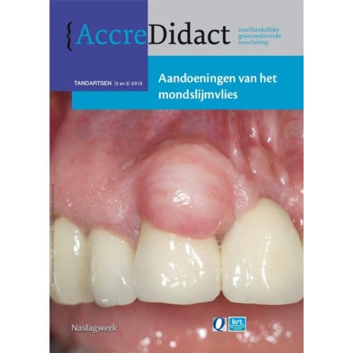 Aandoeningen Van Het Mondslijmvlies - Accredidact - Isaac van der Waal