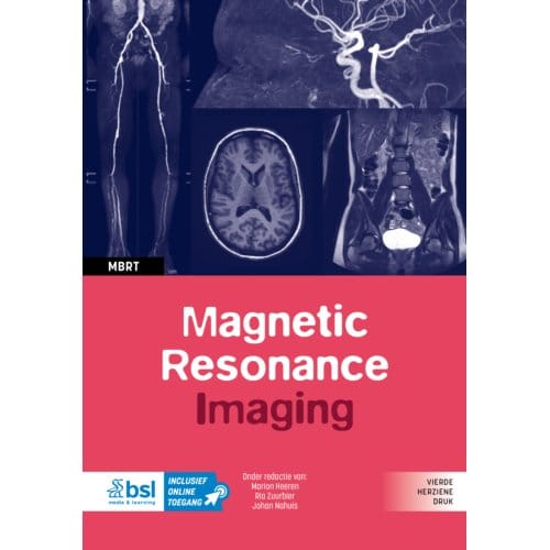 Magnetic Resonance Imaging - Medische Beeldvorming En Radiotherapie