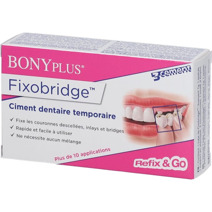 Bonyplus Fixobridge Losgekomen Kronen En Bruggen 7g