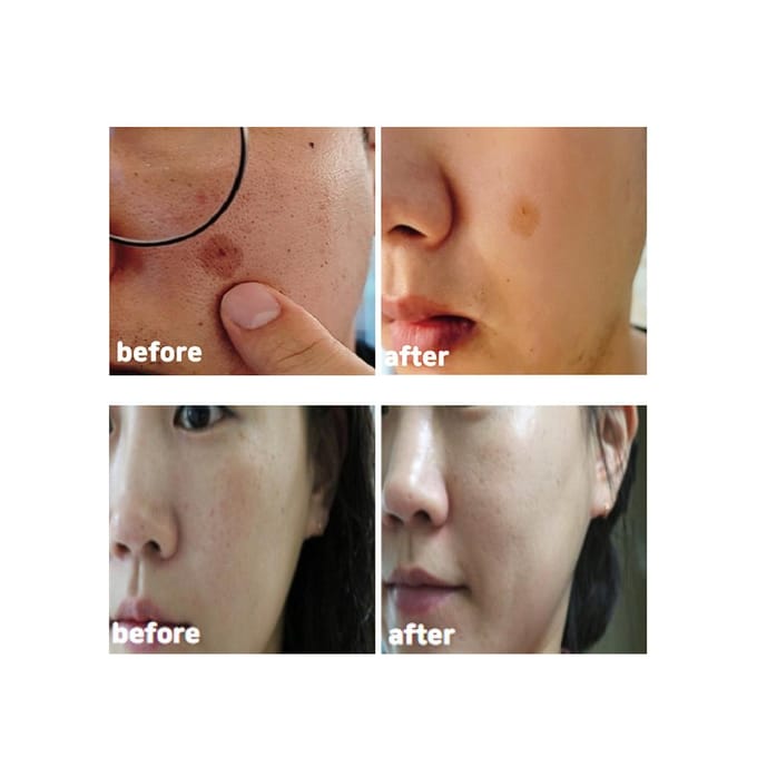 [CELL HAPPY CO] Donkere Vlekken Oplossing Crème 50ml white