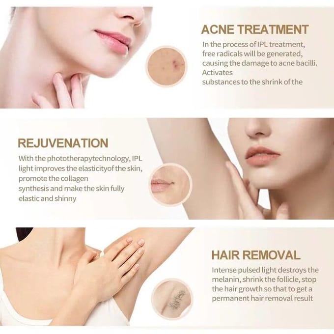 Vancostar Laser Ontharing 999900 Flits Koel Verjonging Acne Behandeling voor Thuis Bikini Trimmer IPL Epilator Schoonheidsapparaat wit