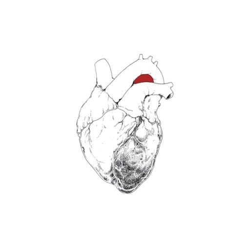 Beggar - Swans