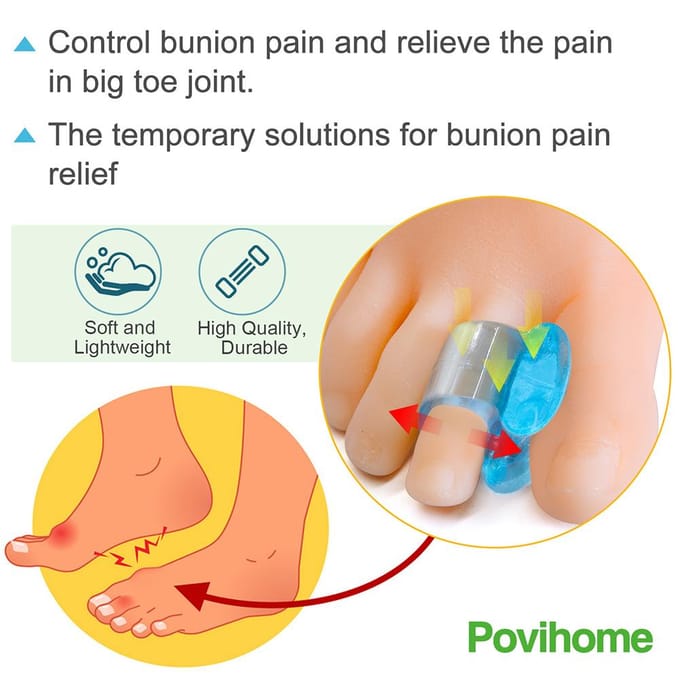 3 Paar Zachte Bunion Spreiders Silicone Gel Teenspreider Duim Corrector Voetverzorgingstool blauw