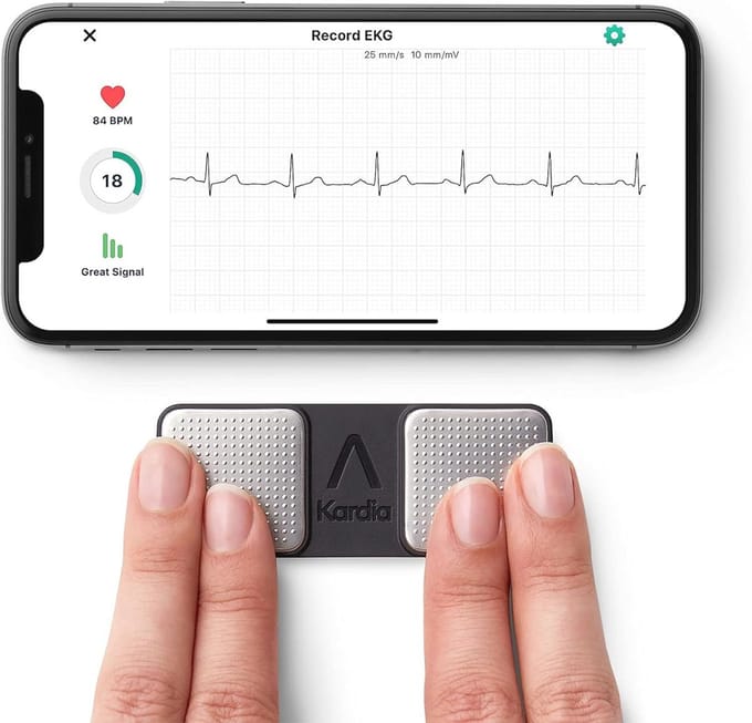 Mobiel ECG-apparaat voor iOS en Android - Controleer uw Hart Gezondheid Altijd en Overal