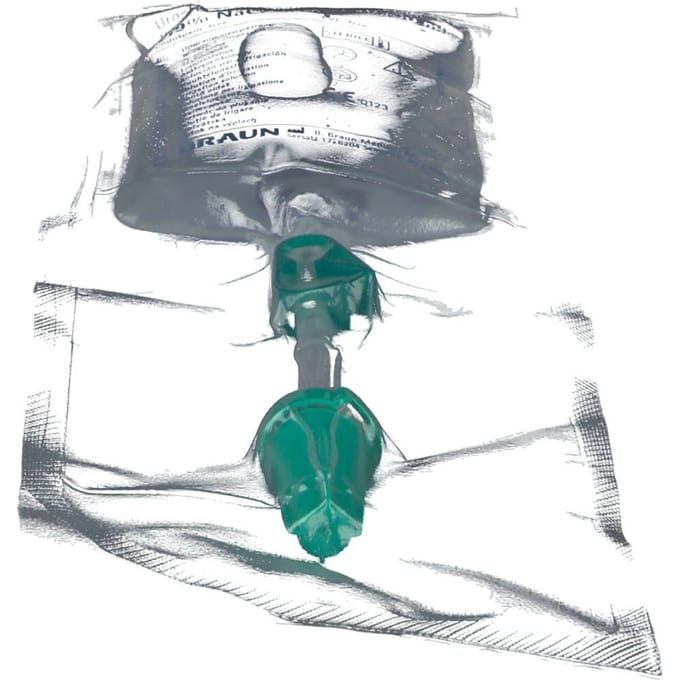 Uro-Tainer NaCl 0,9% 100ml 1 Oplossing