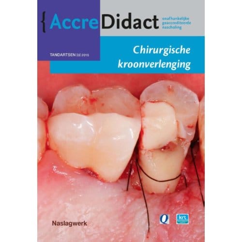 Chirurgische Kroonverlenging - Accredidact - S. Paraskevas