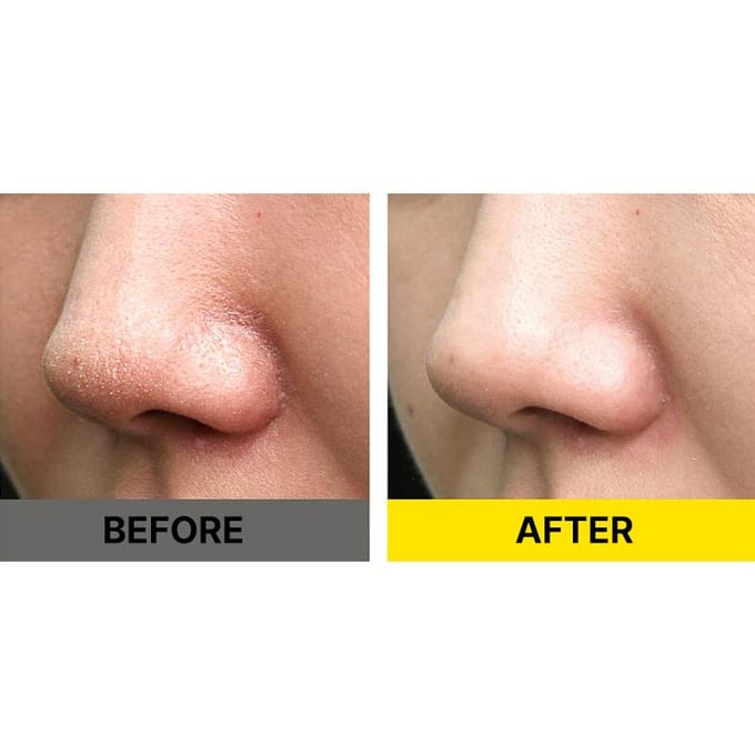 [SIDMOOL] PDRN Spicule Peeling Gel 80ml beige