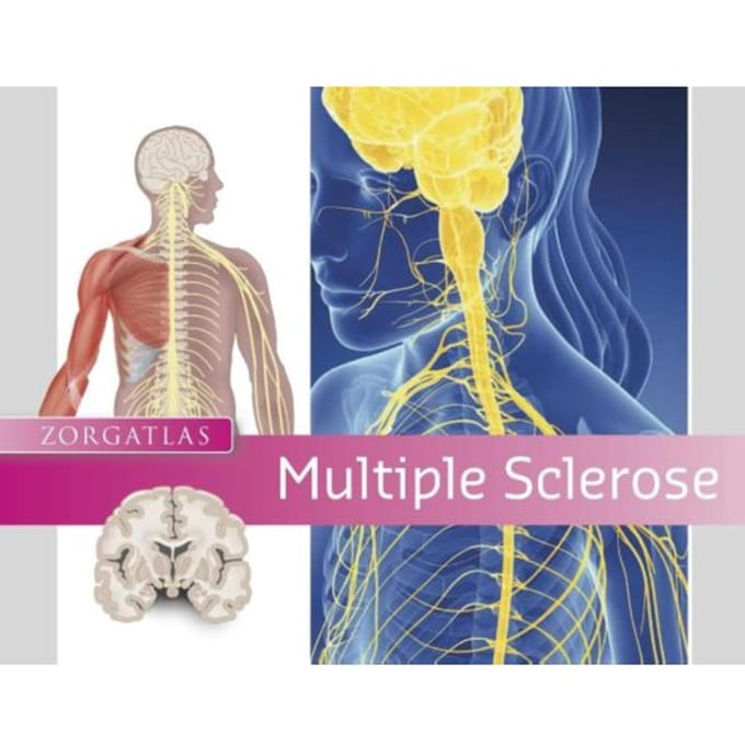 Multiple Sclerose - Zorgatlas - Leonieke Ravestein