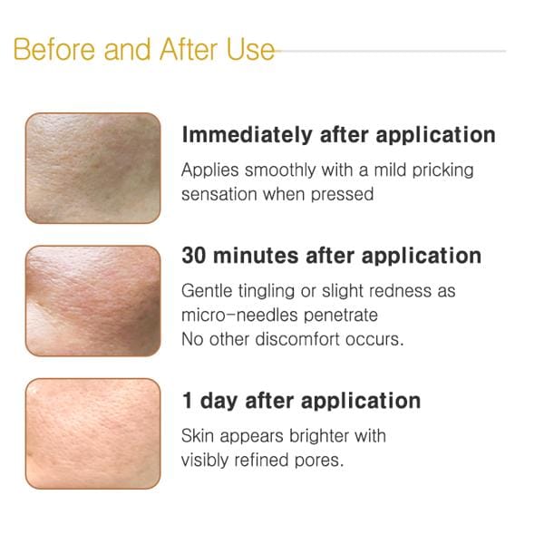Crème Peeling Or Naturel Zangmi (Crème Peeling Micro-Aiguilles) 2gx4ea (3 Options) 3box (2gx12ea)