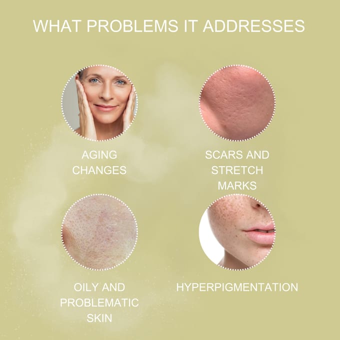 Health Peel TCA peel 25%, pH1.1. / TCA пилинг 25%, pH1.1, 30мл.