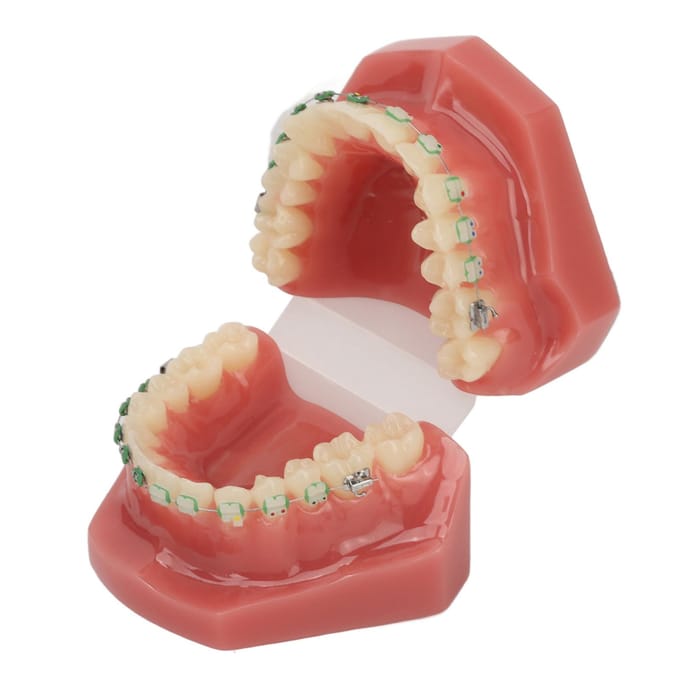 Modèle de démonstration orthodontique dentaire Modèle de dents avec fils métalliques et bracket pour l'enseignement brown