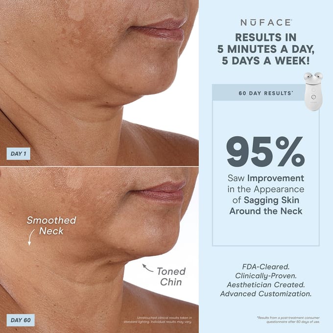 NuFACE TRINITY+® Effective Lip en Eye Attachment