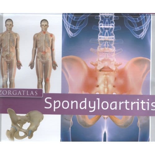 Zorgatlas Spondyloartritis - I.A.A.M. van Echteld