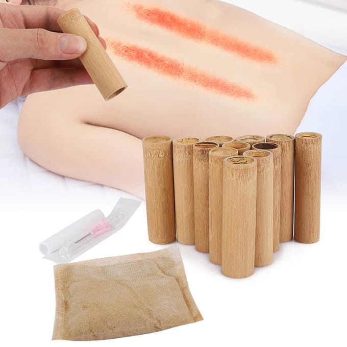 Bamboe Duim Cupping Cup Set Traditionele Geneeskunde Meridiaanbaggering Sterke Zuigkracht Cupping Set beige